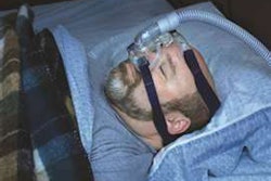 Sleep Apnea