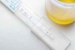 drug test