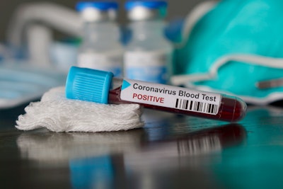 covid-19-coronavirus-2020-03-12-14-40