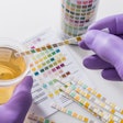 urinalysis drug test