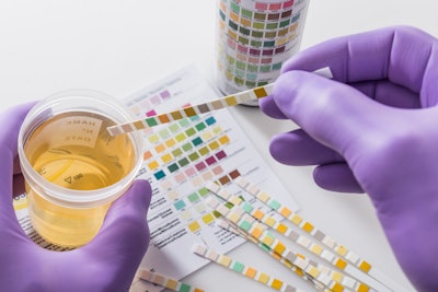 urinalysis drug test