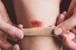 band-aid on a skinned knee