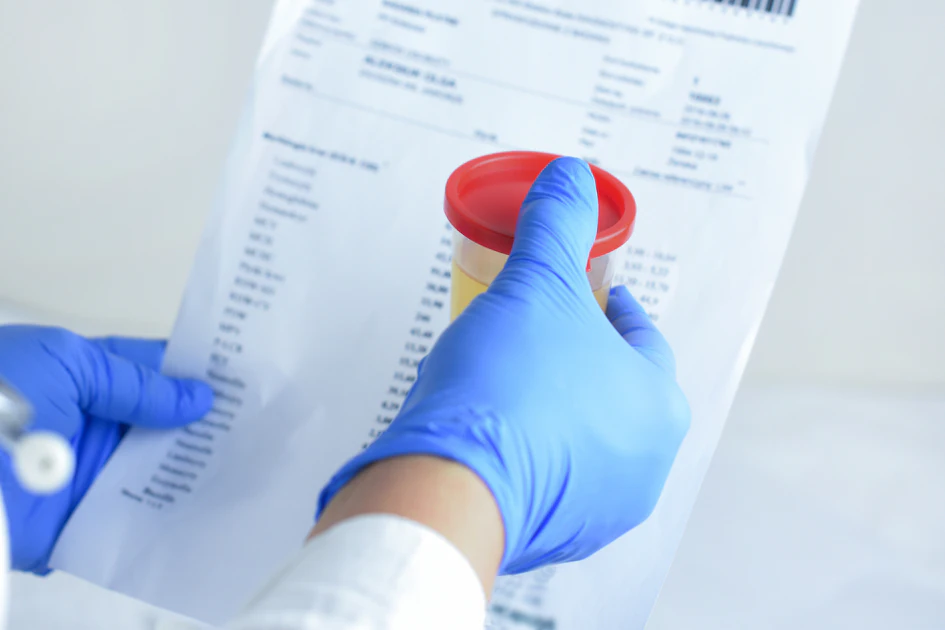 People Getting Random Drug Tested DOT unveils 2026 random drug testing rates | Commercial Carrier Journal