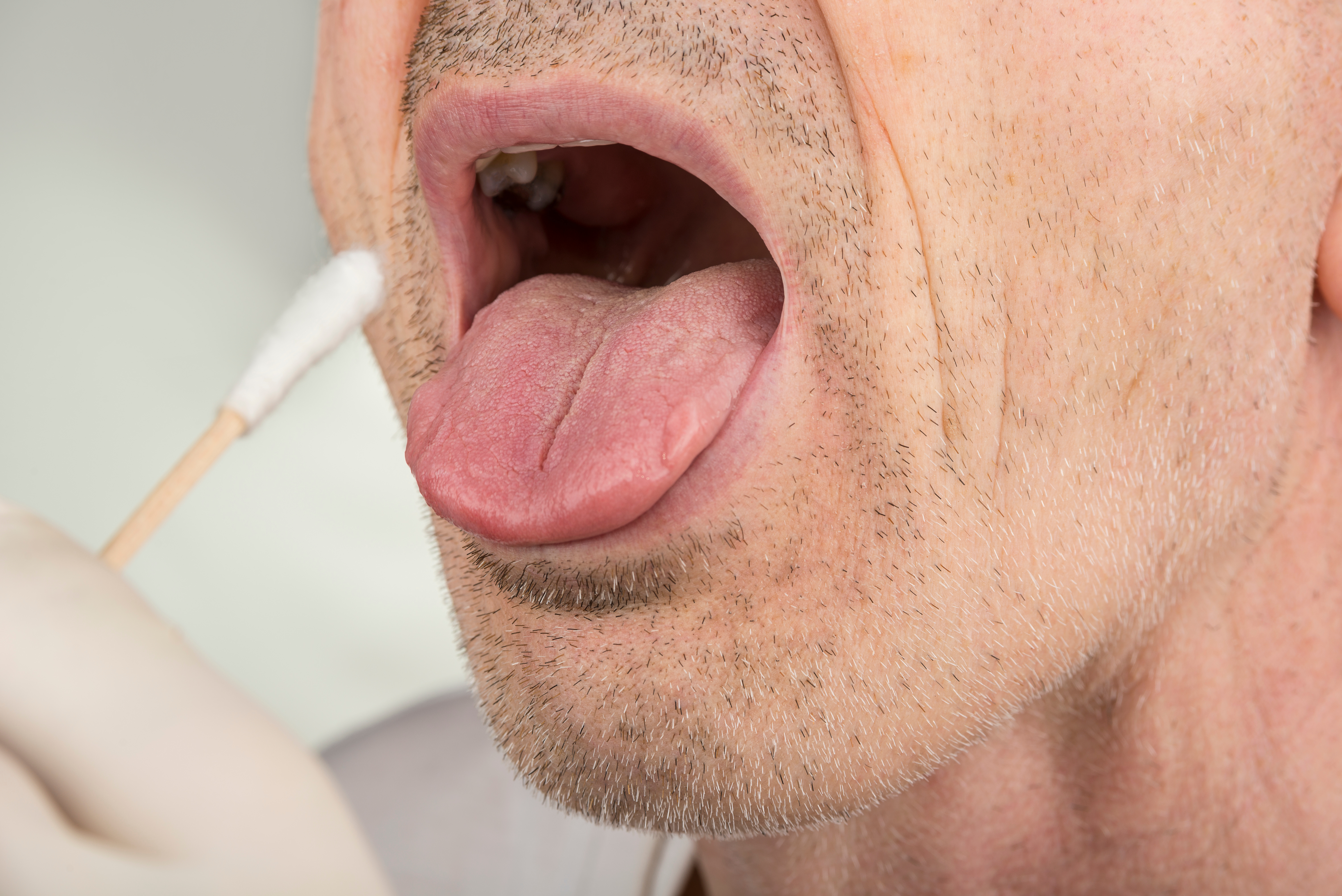 Healthcare provider performing oral swab test on patient's mouth for medical examination