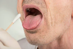 Healthcare provider performing oral swab test on patient's mouth for medical examination